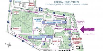 המפה של ג ' ופרה-Dupuytren ח
